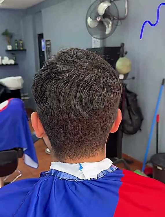 Antes: cabello crecido y disparejo en la nuca, visto desde atrás